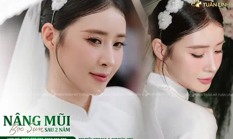 Khách hàng tìm kiếm điều gì sau những hình ảnh “trước – sau” trên mạng xã hội? Góc nhìn từ Viện Thẩm mỹ Tuấn Linh