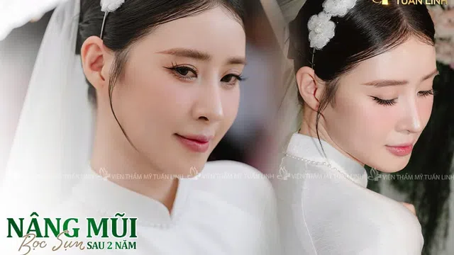 Khách hàng tìm kiếm điều gì sau những hình ảnh “trước – sau” trên mạng xã hội? Góc nhìn từ Viện Thẩm mỹ Tuấn Linh